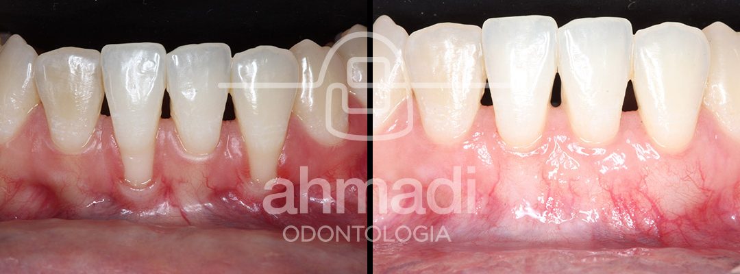 Periodoncia